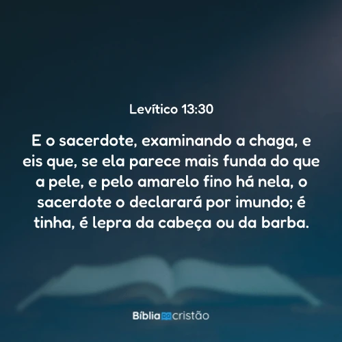 Levítico 13:30