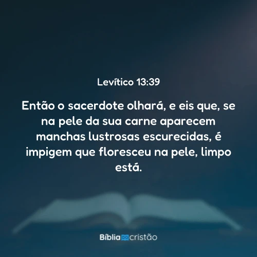 Levítico 13:39
