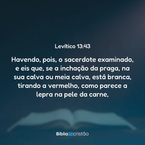 Levítico 13:43